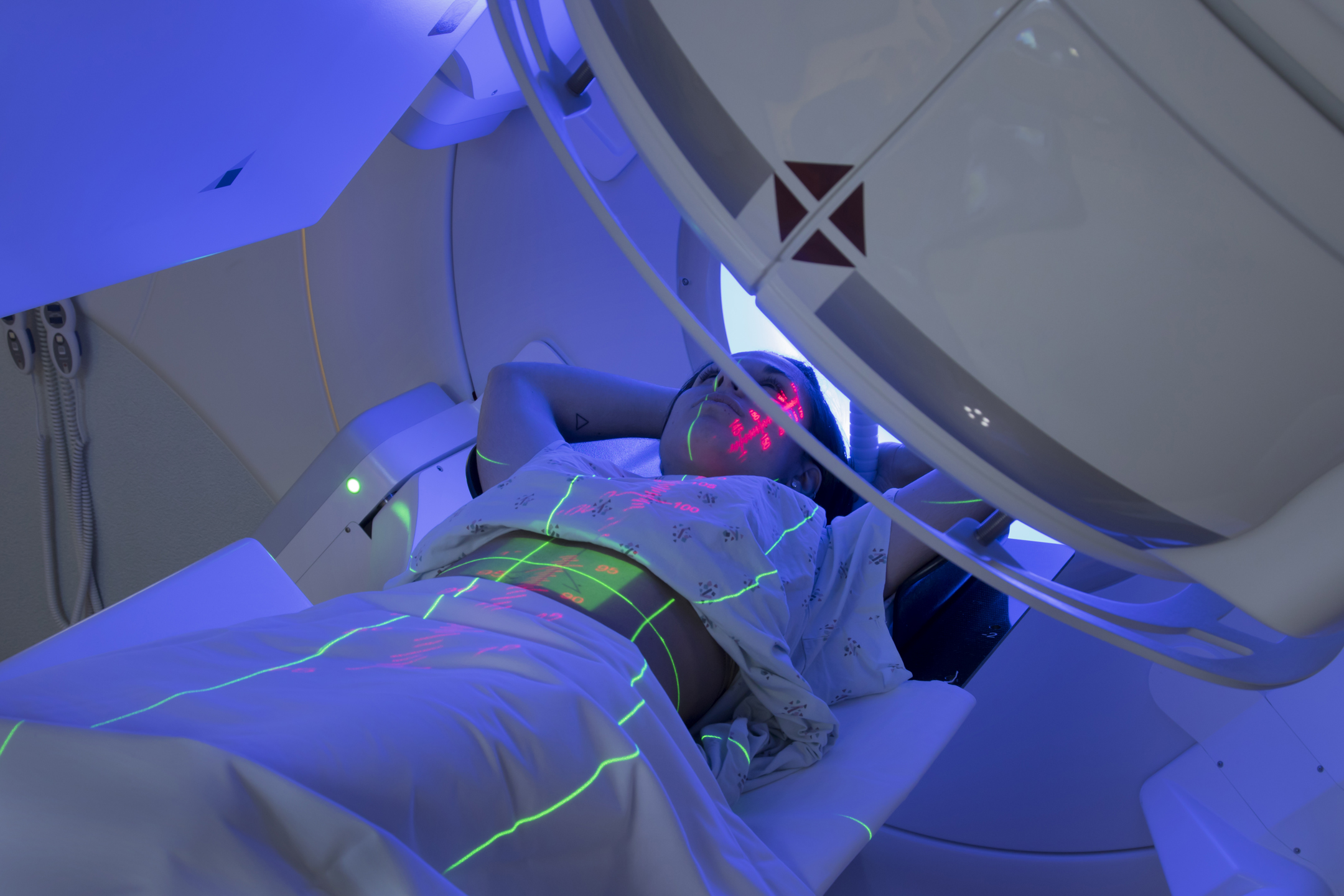 four-major-advances-made-in-external-radiotherapy-for-treating-cancer